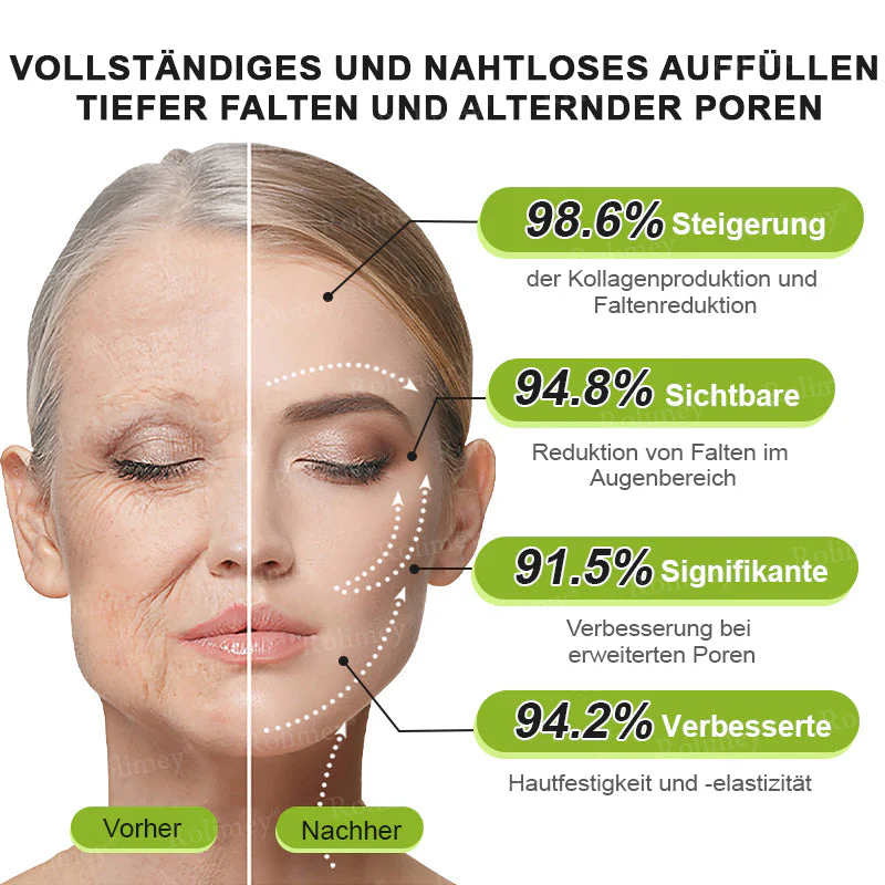 Jetzt jugendliche Haut zurückgewinnen 🍀Rolimey® Botox & Vita-A Retinol Shot Falten-Lift Straffungscreme - Image 16