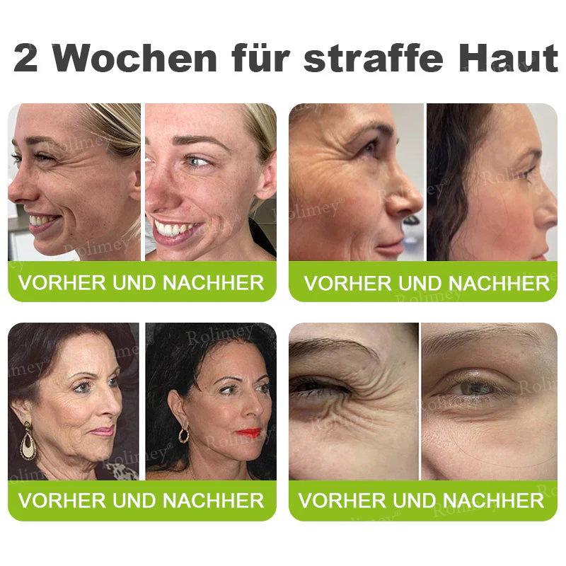 Jetzt jugendliche Haut zurückgewinnen 🍀Rolimey® Botox & Vita-A Retinol Shot Falten-Lift Straffungscreme - Image 6
