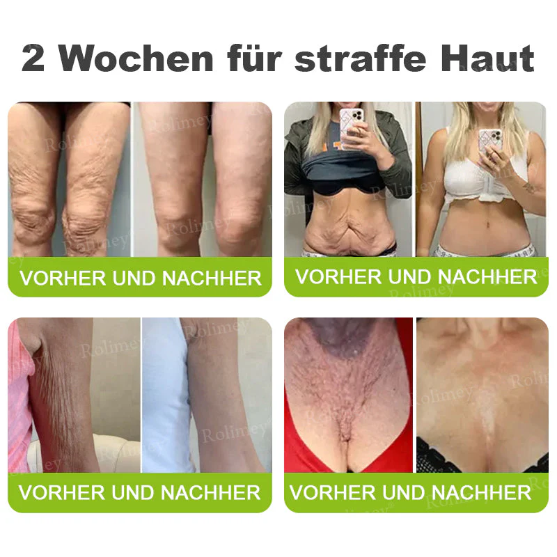 Jetzt jugendliche Haut zurückgewinnen 🍀Rolimey® Botox & Vita-A Retinol Shot Falten-Lift Straffungscreme - Image 7