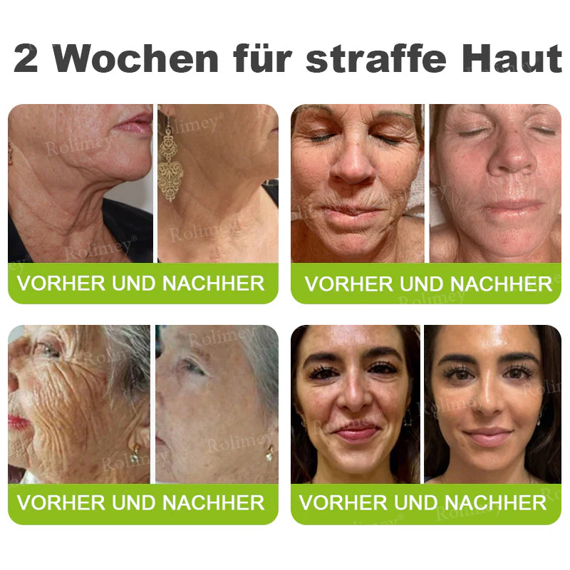 Jetzt jugendliche Haut zurückgewinnen 🍀Rolimey® Botox & Vita-A Retinol Shot Falten-Lift Straffungscreme - Image 8